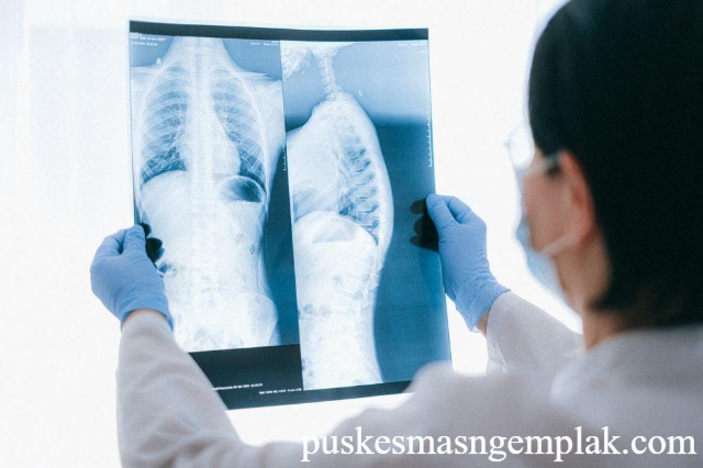 Hipertensi Paru, Penyakit Mematikan yang Kurang Dikenal